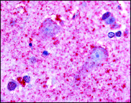 Anti-HTR7 (AB1) antibody produced in rabbit affinity isolated antibody, buffered aqueous solution