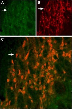 Anti-Potassium Channel KV11.2 (erg2) 兔抗 affinity isolated antibody, lyophilized powder