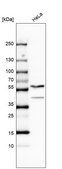 Anti-PAPD7 antibody produced in rabbit Prestige Antibodies® Powered by Atlas Antibodies, affinity isolated antibody, buffered aqueous glycerol solution