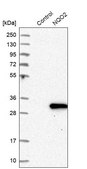Anti-NQO2 antibody produced in rabbit Prestige Antibodies® Powered by Atlas Antibodies, affinity isolated antibody, buffered aqueous glycerol solution, Ab1