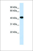 Anti-ADH1B antibody produced in rabbit affinity isolated antibody