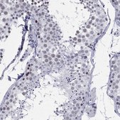 Anti-ASF1B antibody produced in rabbit Prestige Antibodies® Powered by Atlas Antibodies, affinity isolated antibody, buffered aqueous glycerol solution