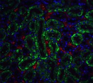 Anti-CAD antibody produced in rabbit affinity isolated antibody