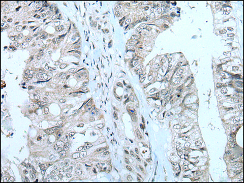 Anti-MTHFR affinity isolated antibody