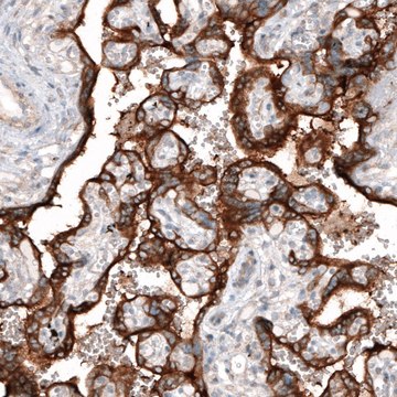 Monoclonal Anti-CLIP1 antibody produced in mouse Prestige Antibodies&#174; Powered by Atlas Antibodies, clone CL4844, purified immunoglobulin, buffered aqueous glycerol solution