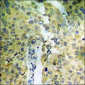 Anti-phospho-BAD (pSer112) antibody produced in rabbit affinity isolated antibody