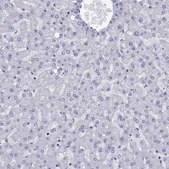 Anti-TRIM46 Prestige Antibodies® Powered by Atlas Antibodies, affinity isolated antibody