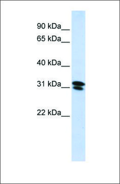 Anti-RNF182 (ab1) antibody produced in rabbit affinity isolated antibody