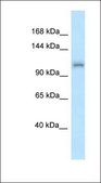 Anti-ZFR antibody produced in rabbit affinity isolated antibody