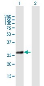 Anti-COG8 antibody produced in mouse purified immunoglobulin, buffered aqueous solution