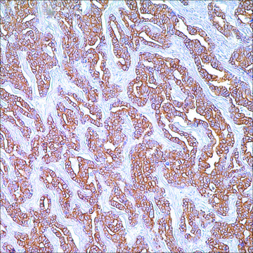 Cytokeratin Cocktail (AE1 &amp; AE3) Mouse Monoclonal Antibody