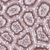 Anti-UBN1 antibody produced in rabbit Prestige Antibodies® Powered by Atlas Antibodies, affinity isolated antibody, buffered aqueous glycerol solution