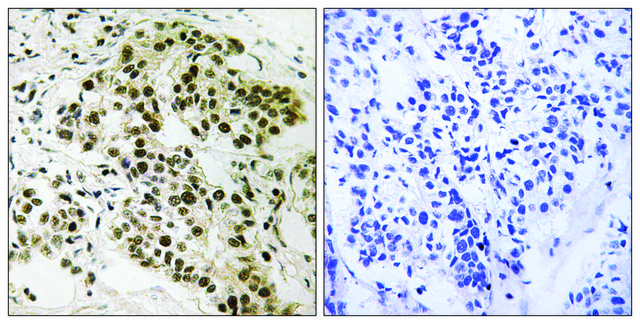 Anti-Retinoblastoma antibody produced in rabbit affinity isolated antibody