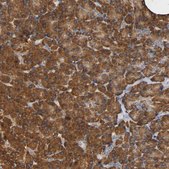 Anti-NDUFS3 antibody produced in rabbit Prestige Antibodies® Powered by Atlas Antibodies, affinity isolated antibody, buffered aqueous glycerol solution