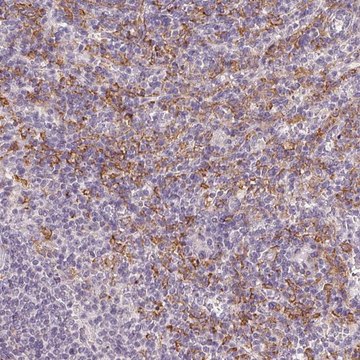 Anti-IFNGR1 antibody produced in rabbit Prestige Antibodies&#174; Powered by Atlas Antibodies, affinity isolated antibody, buffered aqueous glycerol solution