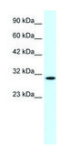 Anti-CDC2 (C-terminal) antibody produced in rabbit affinity isolated antibody