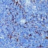 Anti-Fascin/FSCN1 antibody produced in rabbit