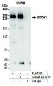 Rabbit anti-BRCA1 Antibody, Affinity Purified Powered by Bethyl Laboratories, Inc.