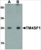 Anti-TM4SF1 antibody produced in rabbit affinity isolated antibody