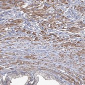 Anti-SMS antibody produced in rabbit Prestige Antibodies® Powered by Atlas Antibodies, affinity isolated antibody, buffered aqueous glycerol solution, ab2