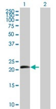 Anti-BTC antibody produced in mouse purified immunoglobulin, buffered aqueous solution