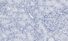 Anti-Insulin Receptor β Antibody, clone 1J16 ZooMAb® Rabbit Monoclonal recombinant, expressed in HEK 293 cells