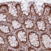 Anti-MORF4L2 antibody produced in rabbit Prestige Antibodies® Powered by Atlas Antibodies, affinity isolated antibody, buffered aqueous glycerol solution