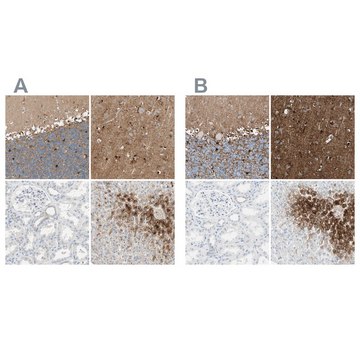 Anti-GLUL antibody produced in rabbit Ab2, Prestige Antibodies® Powered by Atlas Antibodies, affinity isolated antibody, buffered aqueous glycerol solution