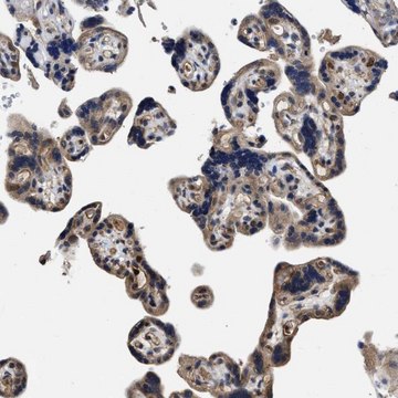 抗-TRAF6 兔抗 Prestige Antibodies&#174; Powered by Atlas Antibodies, affinity isolated antibody, buffered aqueous glycerol solution, Ab1