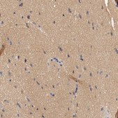 Anti-HGS antibody produced in rabbit Prestige Antibodies® Powered by Atlas Antibodies, affinity isolated antibody, buffered aqueous glycerol solution