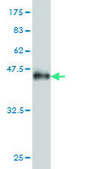 Monoclonal Anti-ANKRA2 antibody produced in mouse clone 1D11, purified immunoglobulin, buffered aqueous solution