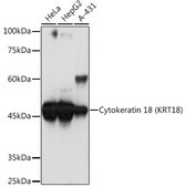 Anti-Cytokeratin 18 (KRT18) Antibody, clone 7B2N3, Rabbit Monoclonal
