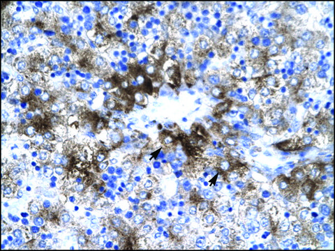 Anti-PIAS3 antibody produced in rabbit IgG fraction of antiserum