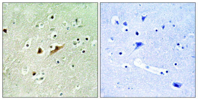 Anti-RGAP1 antibody produced in rabbit affinity isolated antibody