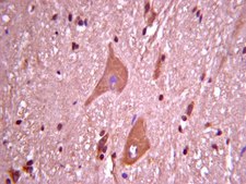 Anti-Neurogenin-3 Antibody, a.a. 80-93 of mouse Neurogenin-3. Chemicon®, from rabbit