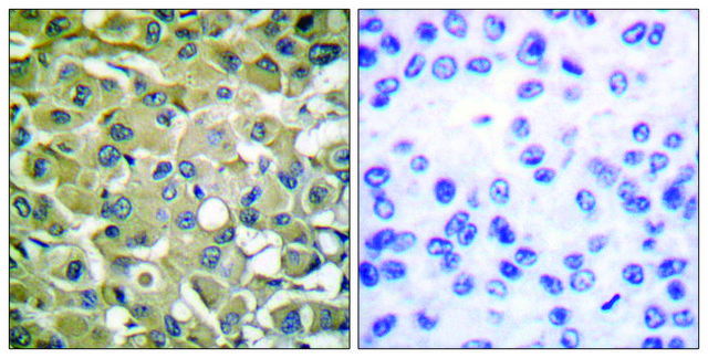 Anti-Keratin 18 antibody produced in rabbit affinity isolated antibody