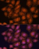 Anti-SMYD3 antibody produced in rabbit