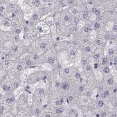 Anti-GRK1 antibody produced in rabbit Prestige Antibodies® Powered by Atlas Antibodies, affinity isolated antibody