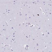 Anti-SPN antibody produced in rabbit Prestige Antibodies® Powered by Atlas Antibodies, affinity isolated antibody, buffered aqueous glycerol solution
