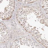Anti-TTLL4 antibody produced in rabbit Prestige Antibodies® Powered by Atlas Antibodies, affinity isolated antibody, buffered aqueous glycerol solution