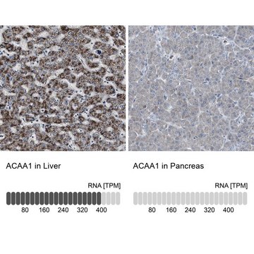 抗-ACAA1 兔抗 Ab2, Prestige Antibodies&#174; Powered by Atlas Antibodies, affinity isolated antibody, buffered aqueous glycerol solution