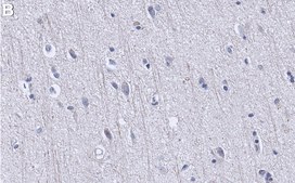Anti-Tau Antibody, clone Tau-5 ZooMAb® Mouse Monoclonal recombinant, expressed in HEK 293 cells