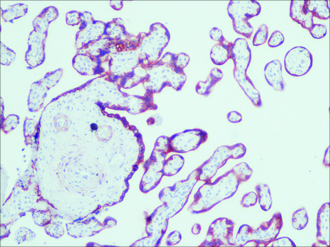 Anti-Cytokeratin, pan antibody, Mouse monoclonal clone PCK-26, purified from hybridoma cell culture