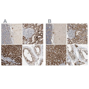 Anti-ACAT1 antibody produced in rabbit Ab1, Prestige Antibodies&#174; Powered by Atlas Antibodies, affinity isolated antibody, buffered aqueous glycerol solution