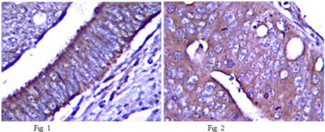 Anti-Notch 1 Antibody, extracellular from rabbit, purified by affinity chromatography