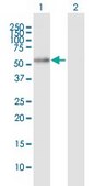 Anti-ALDH7A1 antibody produced in mouse IgG fraction of antiserum, buffered aqueous solution