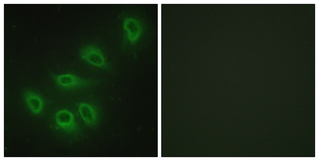 Anti-ENOS antibody produced in rabbit affinity isolated antibody