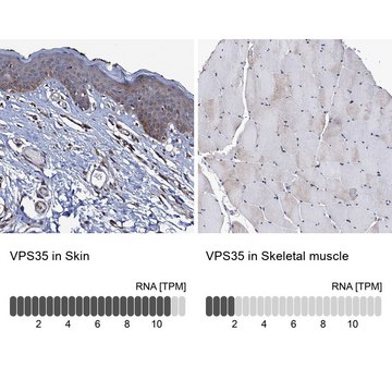 Anti-VPS35 antibody produced in rabbit Prestige Antibodies&#174; Powered by Atlas Antibodies, affinity isolated antibody, buffered aqueous glycerol solution