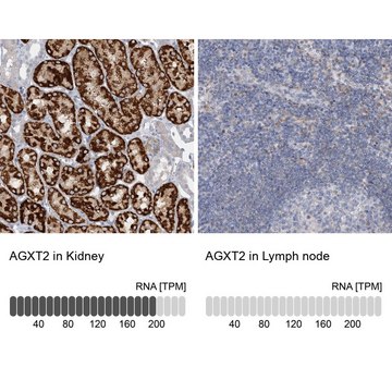 Anti-AGXT2 antibody produced in rabbit Prestige Antibodies&#174; Powered by Atlas Antibodies, affinity isolated antibody, buffered aqueous glycerol solution