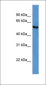 Anti-FTO antibody produced in rabbit affinity isolated antibody